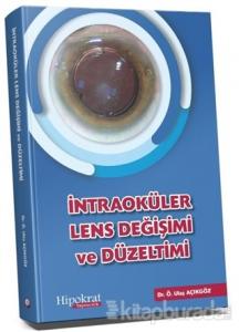 İntraoküler Lens Değişimi ve Düzeltimi